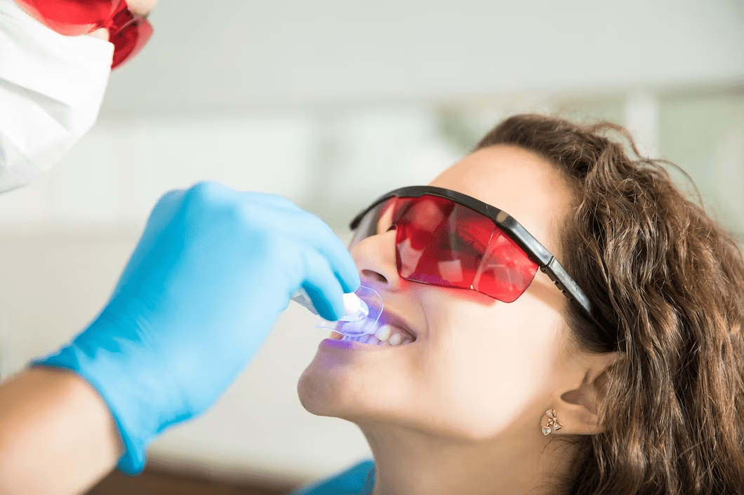Laser Teeth Bleaching Treatment in Hyderabad