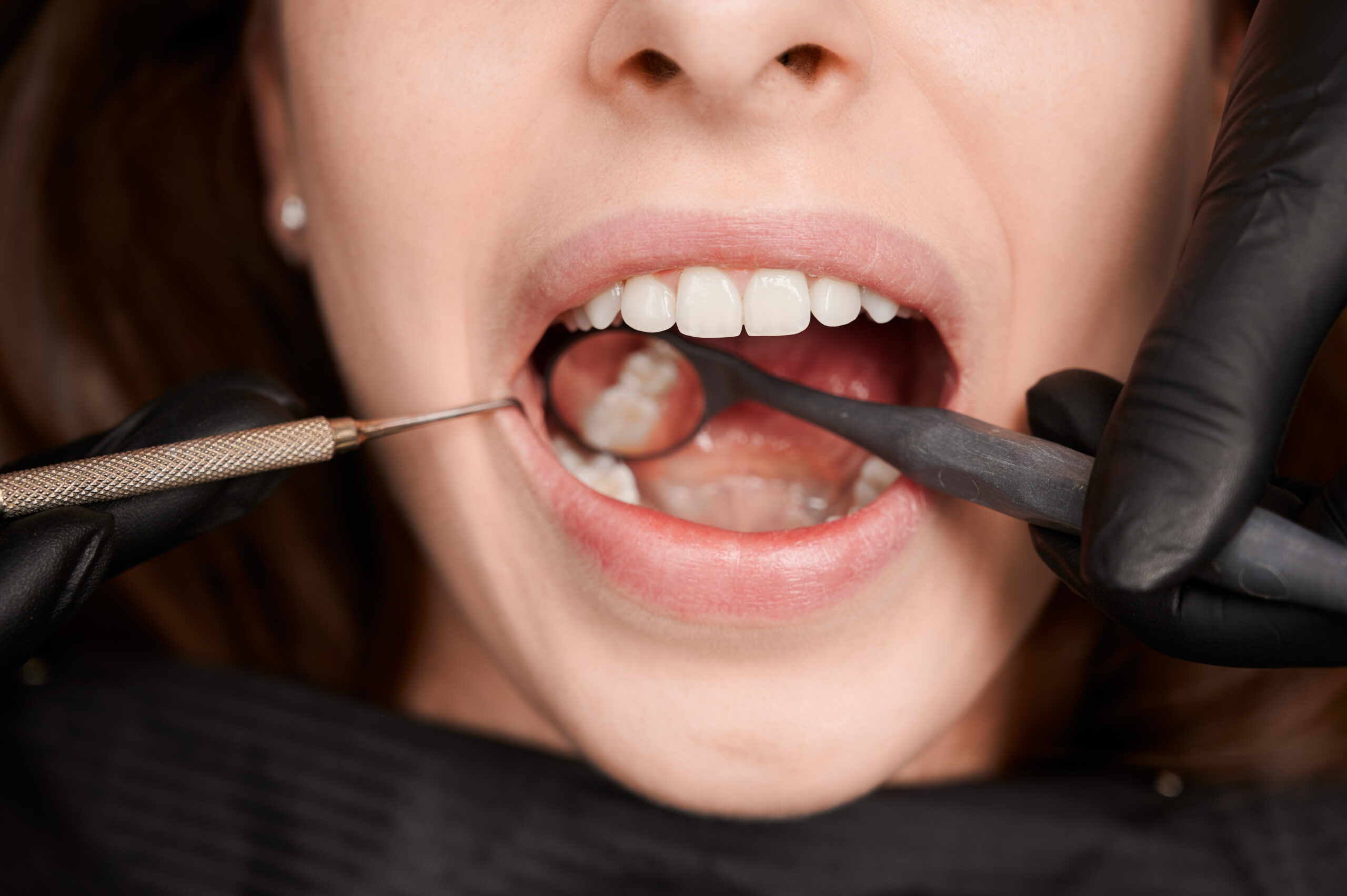 Orthodontics Treatment In Hyderabad