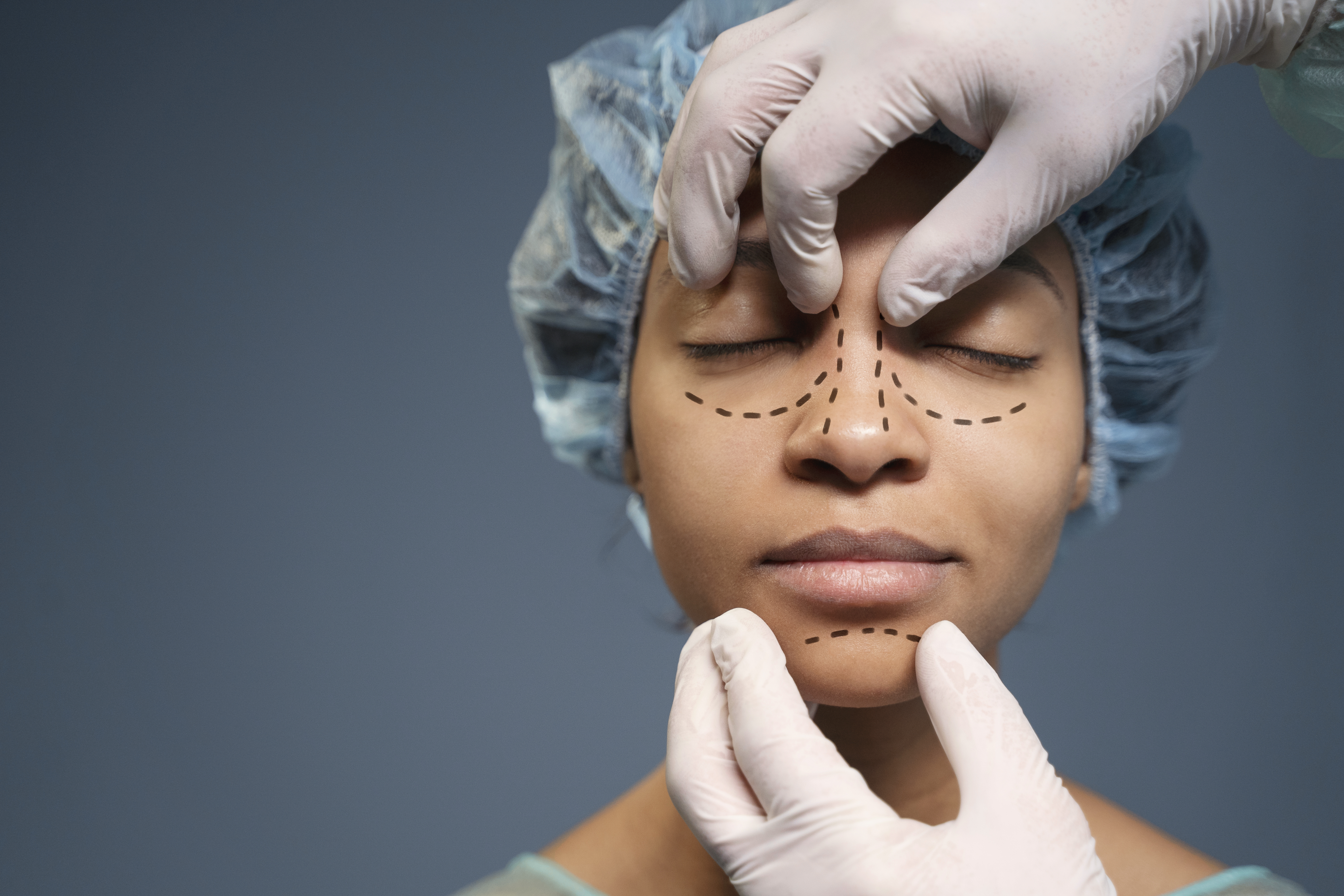 Facial Injuries Surgery In Hyderabad